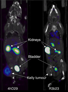 Noninvasive SPECT-CT imaging of Kelly neuroblastoma cells 